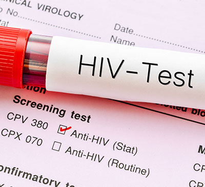 HIV-AIDS Testing Market by End-users and Geography - Forecast and Analysis 2019-2023